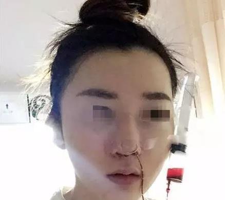 捂人口鼻十分钟会怎么样_三国杀钟会