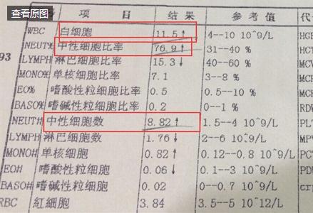 病毒性感冒和细菌性感冒的区别,各位宝爸宝妈最强-性感风骚6088250000图片
