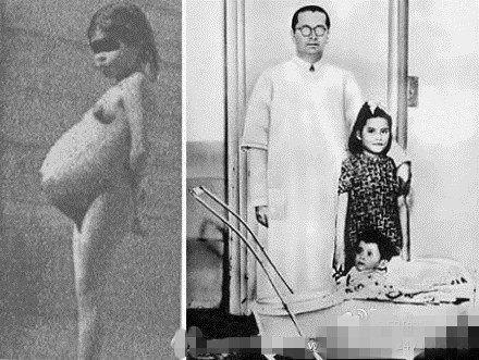 这个女孩儿5岁就怀孕产子了，不知父亲是谁，原因至今成谜！