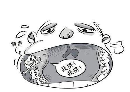 智齿不疼不痒究竟要不要拔掉? 听听牙科医生是怎么说的!