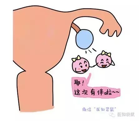 异卵双生:简而言之就是卵子是不同的,也就是当月有两颗卵子自卵巢