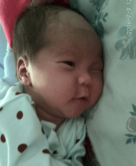 宝宝出生后头上长脓包, 妈妈急坏了, 医院一查乐