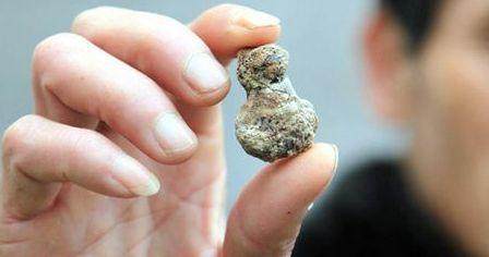 肾结石痛起来真要命,这些食物可以预防和排出