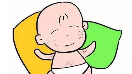 为什么宝宝会长痱子?