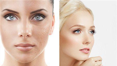 脸部毛孔粗大的问题教你轻松解决的方法|去角质|毛孔|食品_新浪网