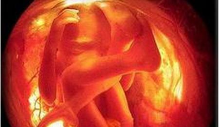 何以辨性别?四维彩超看男女看哪些数据 7个数