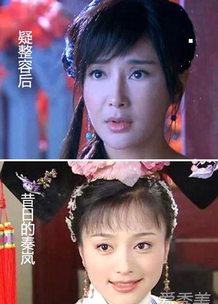日本女星花两千万整容变女鬼，全身动刀50多处