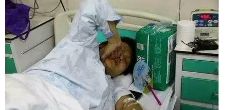 剖腹产预约三天后"卸货",孕妇一念之差, 一夜之间胎死腹中