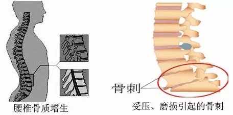 名目繁多的体检套餐该怎么选择?结果出现异常