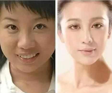 她是06年超女，10年整容从大妈变少女，如今嫁给阿宝身价上亿