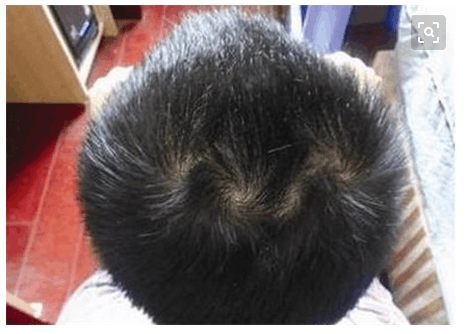 儿子长了3个发旋,可以进来看看这篇文章