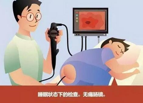 为什么大夫建议您每年做一次肠镜检查?