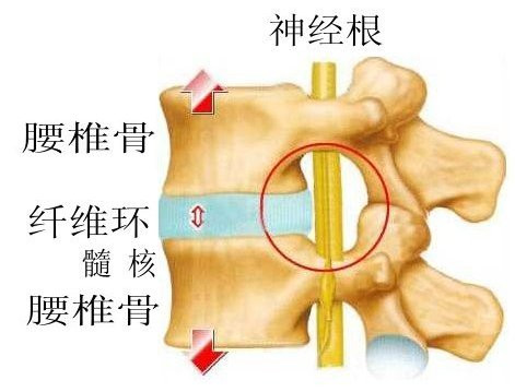 只需按摩这几个穴位 就能轻松缓解腰椎间盘突出!不知道的快看