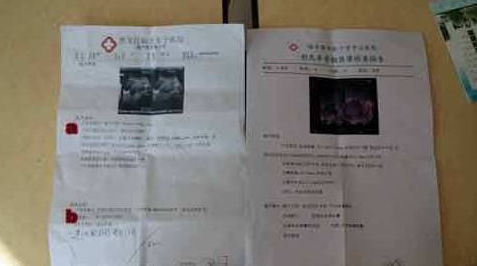 Ů��̱���Դ�18�꣬ȴ���⻳�У���֪�����ĸ�׳��ױ�����