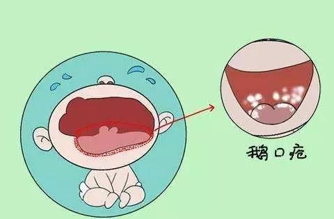 儿童常见口腔疾病有哪些?