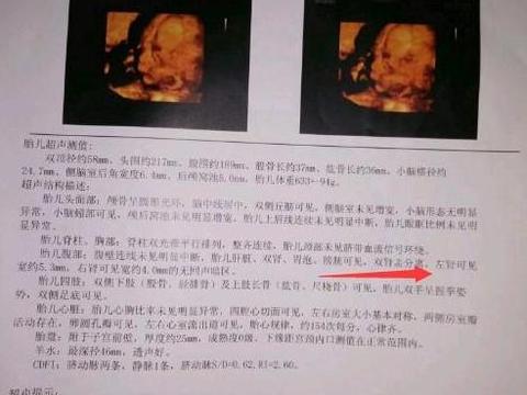 b超单子判断男女,据说看到这几个字,百分之九十是男宝!