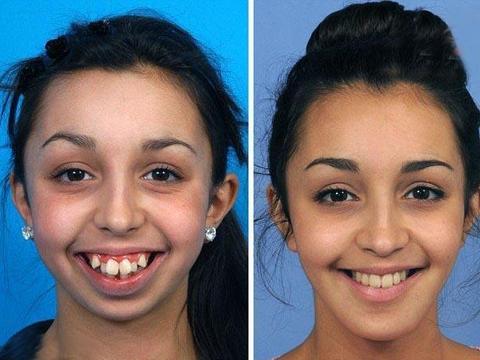 于朦胧曾谈名字由来