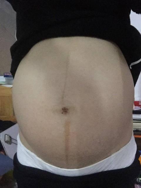 22周5天，B超数据都指向男宝几率大，附上我的孕期男宝症状