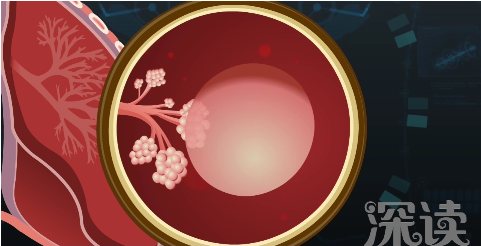 惊艳科普大片!肺大泡、气胸,无法舒展的肺,气喘