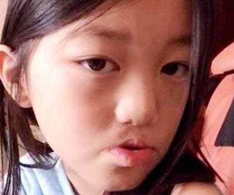 李嫣手术成功颜值恢复 , 网友:绝对是女神级别的