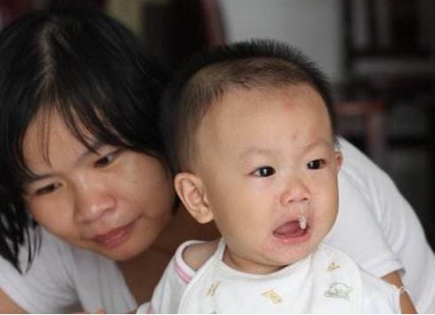 宝宝流鼻涕,不一定是感冒,不要每次都吃感冒药