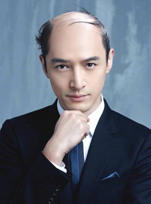 单位6月效果-雍男人常按五个地方不做地中海【图】地中海发型怎么治?