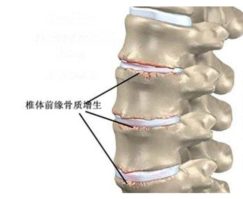 得了颈椎病,头晕手麻不用担心,学会这个按摩穴