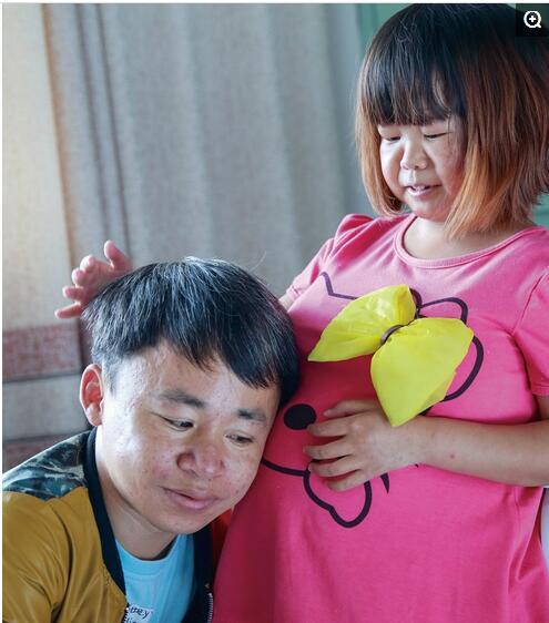 实在袖珍人夫妻的日常生活,原来袖珍人也可以活得这么幸福