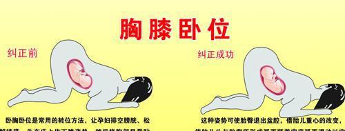 孕妇胎位不正?别慌,这2个实用的方法可以帮到你!