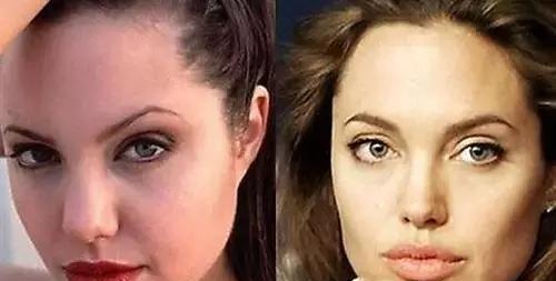 让人大吃一惊，“黑寡妇”斯嘉丽约翰逊、安吉丽娜朱莉的整容史！