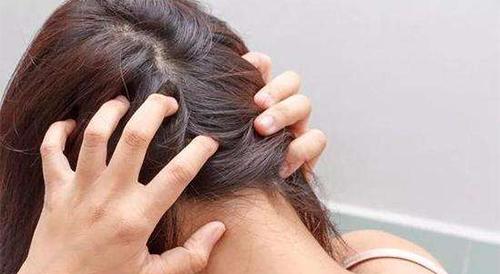 头发油、脱发断发是头皮衰老的信号,3方法头发