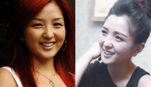 盘点那些整过容的女明星，她们都大方承认了！