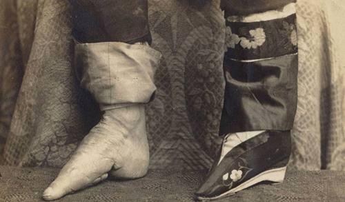 小脚妻三寸金莲图片