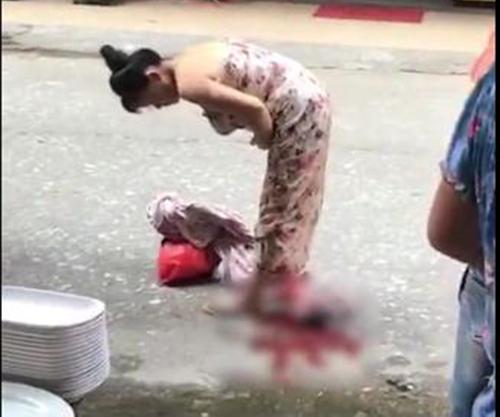 走路生or厕所生,具备什么条件的准妈妈顺产又