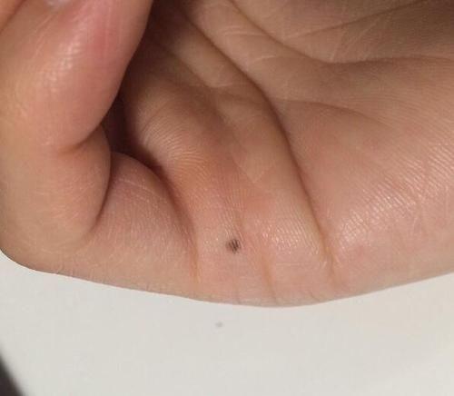 有黑痣是什么含义? 看手相黑痣算命图解!