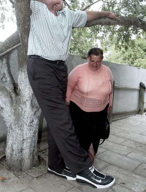第一高人乌克兰男子因患巨人症 3年长高30厘米
