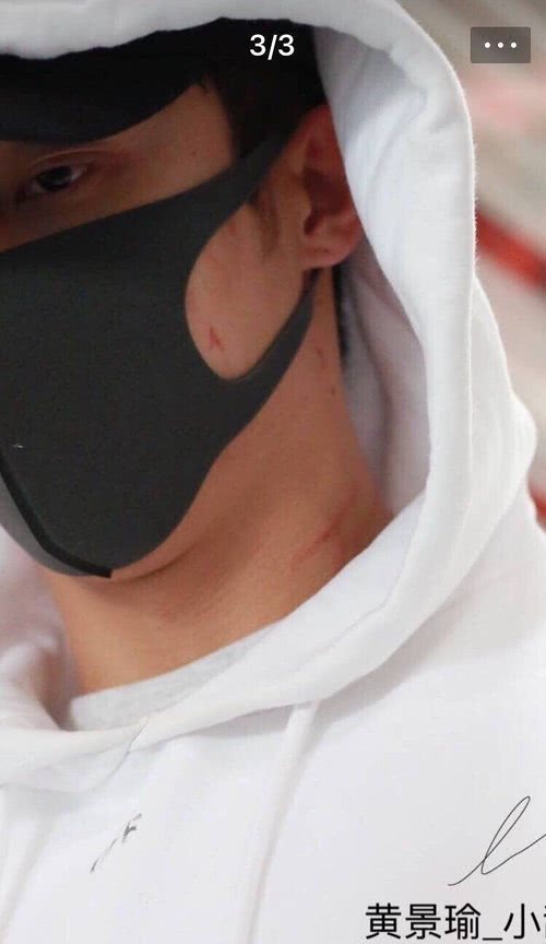 这是怎么回事?一言不合打了一架?