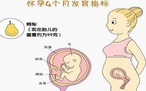 怀孕中期腰酸痛该怎么办,该如何避免要酸痛呢?