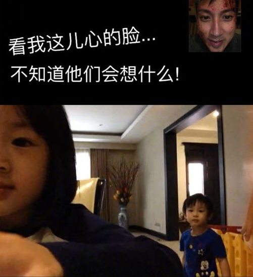 吴尊拍新戏溃烂脸照曝光！惊悚样吓坏儿女