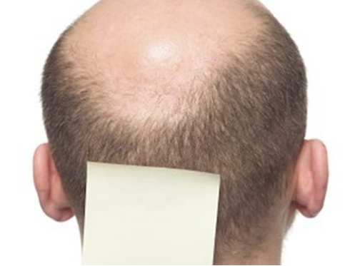 脂溢性皮炎怎么治面部,用这个半个月马上痊愈