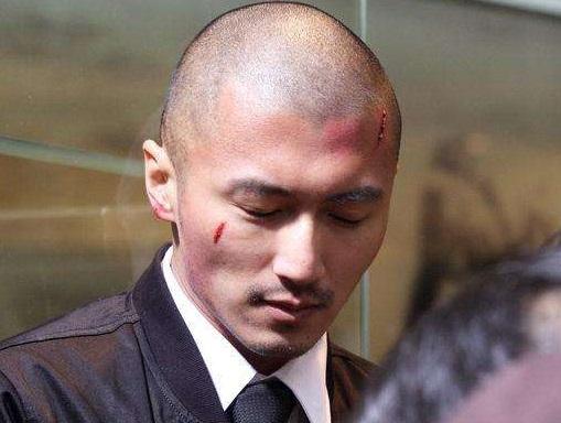 李亚鹏头发越来越多,谢霆锋头发却越来越少