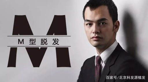 M型脱发，只能使用这种治脱方式！