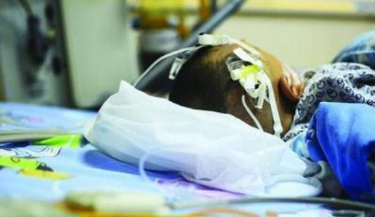 1岁宝宝突然昏迷,医生脑ct查出真相,打开后脑勺