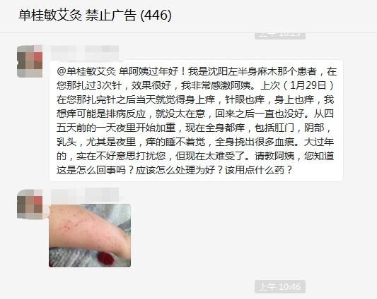 为什么会全身瘙痒?