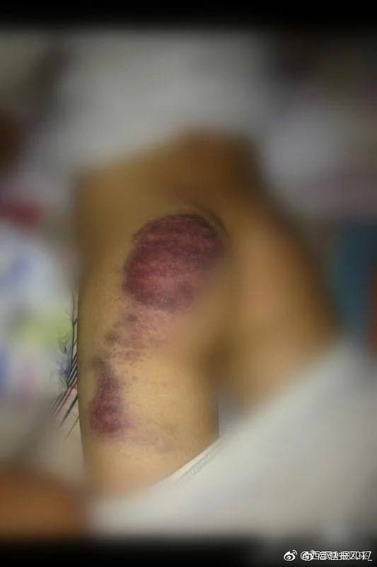 志丹县教育局局长薛治银不被追责反升民政局长