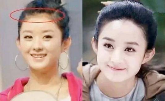 女星修发际线能改运,奚梦瑶的发际线是不是白调了?