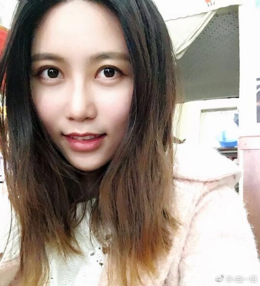 北京自体脂肪填充全脸案例分享,术前术后一个