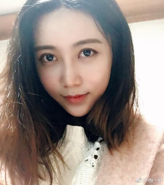 北京自体脂肪填充全脸案例分享,术前术后一个