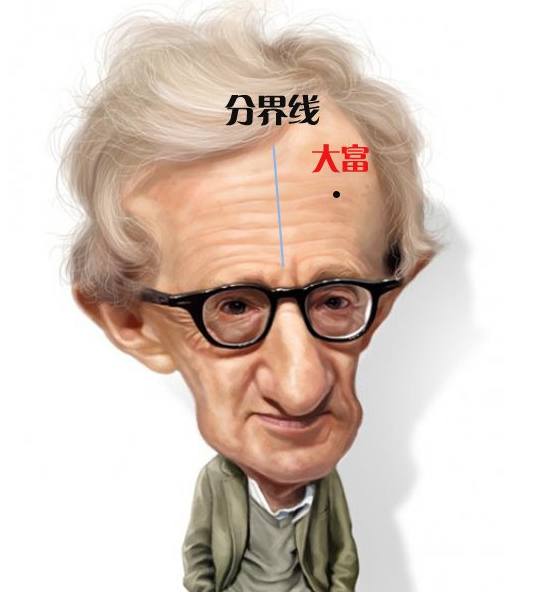 痣分“好坏”，脸上痣看运势，你的脸上是“好”多还是“坏”多？