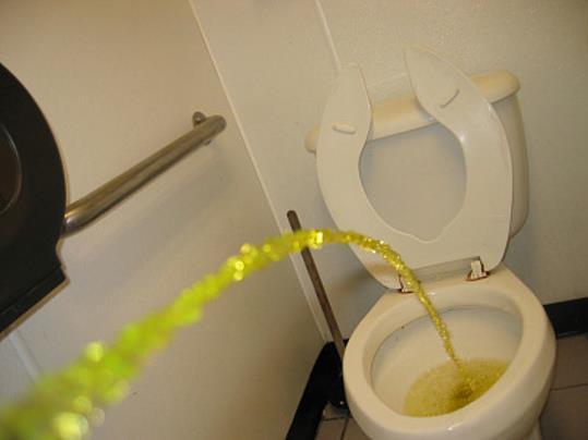 一天尿多少算正常?专家:少尿威胁生命!教你怎